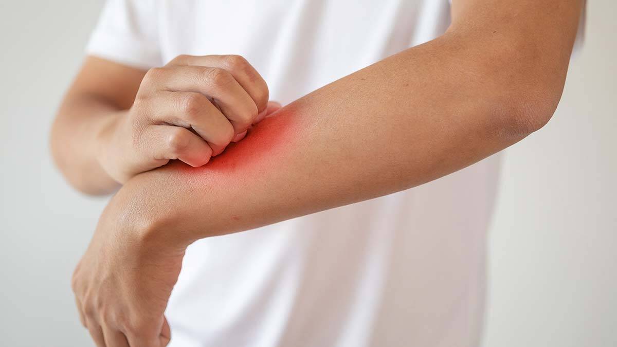 Yazın artan mantar enfeksiyonuna dikkat