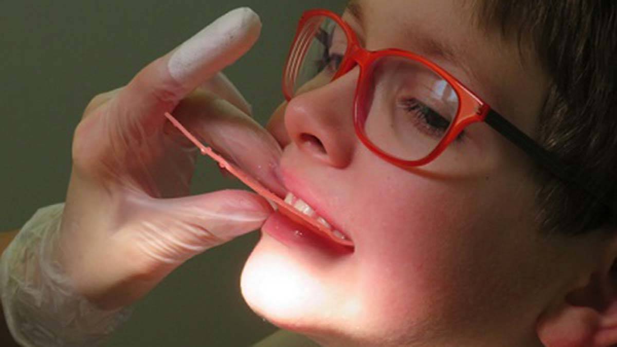 Pedodontist: İlk diş muayenesi süt dişi çıktığında