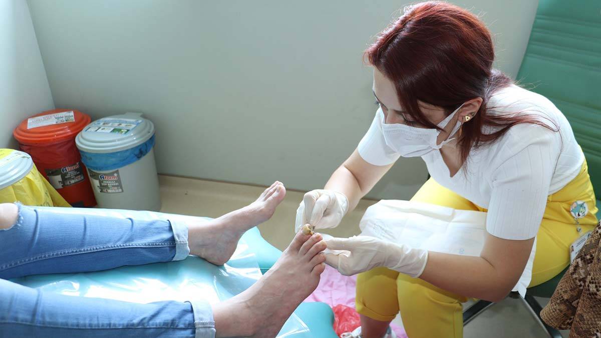 Samsun'da açık yara tedavisinde larva kullanılıyor