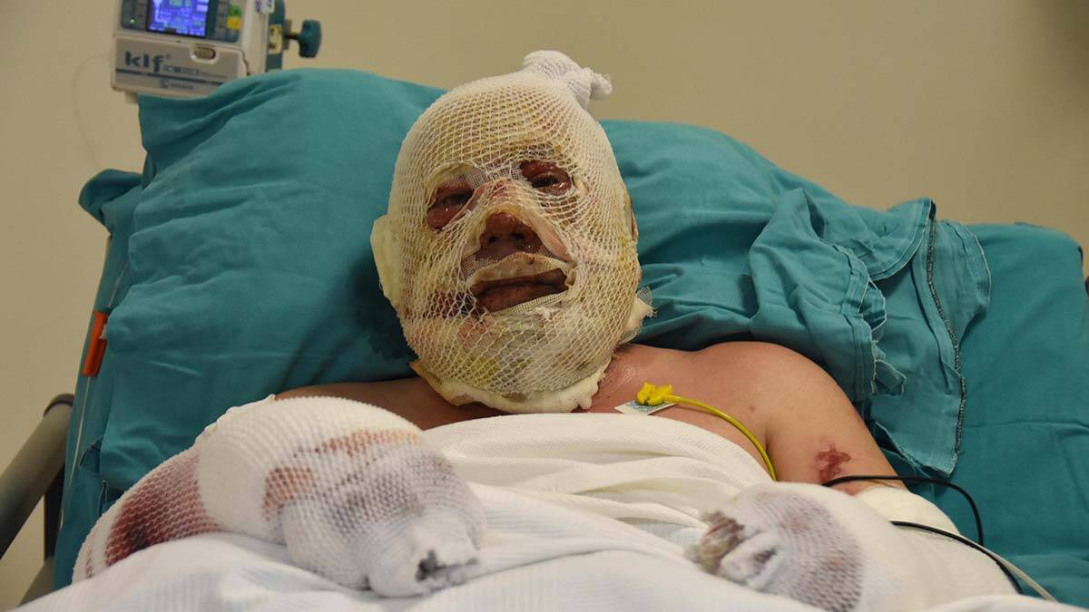 Yanan orman memuru o anları anlattı