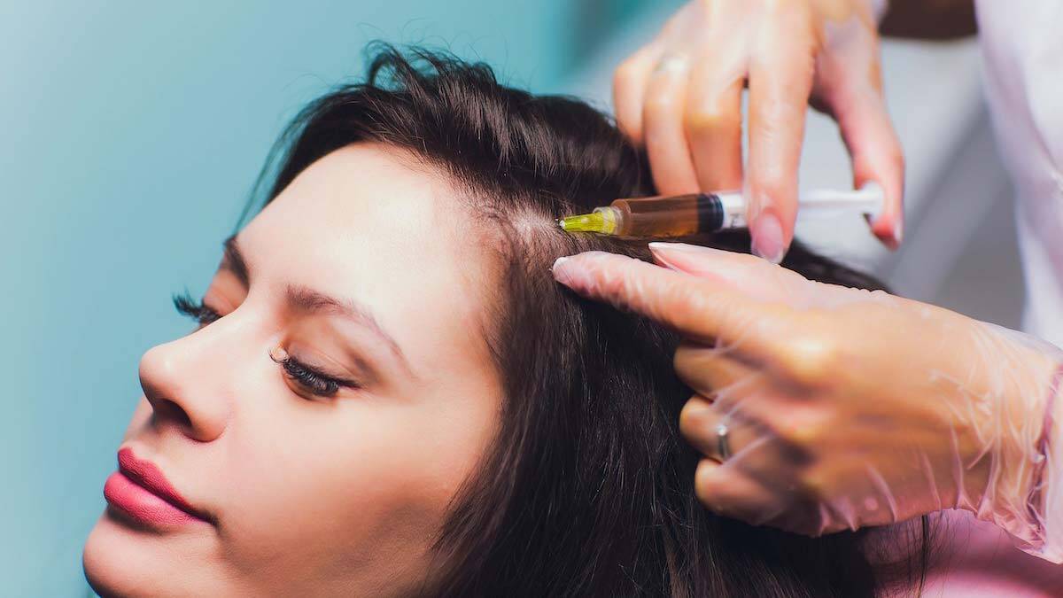 Saç problemlerine PRP çözümü