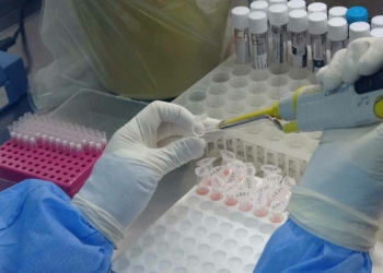 Prof. Dr. Aydın yüksek vakaların nedenini açıkladı