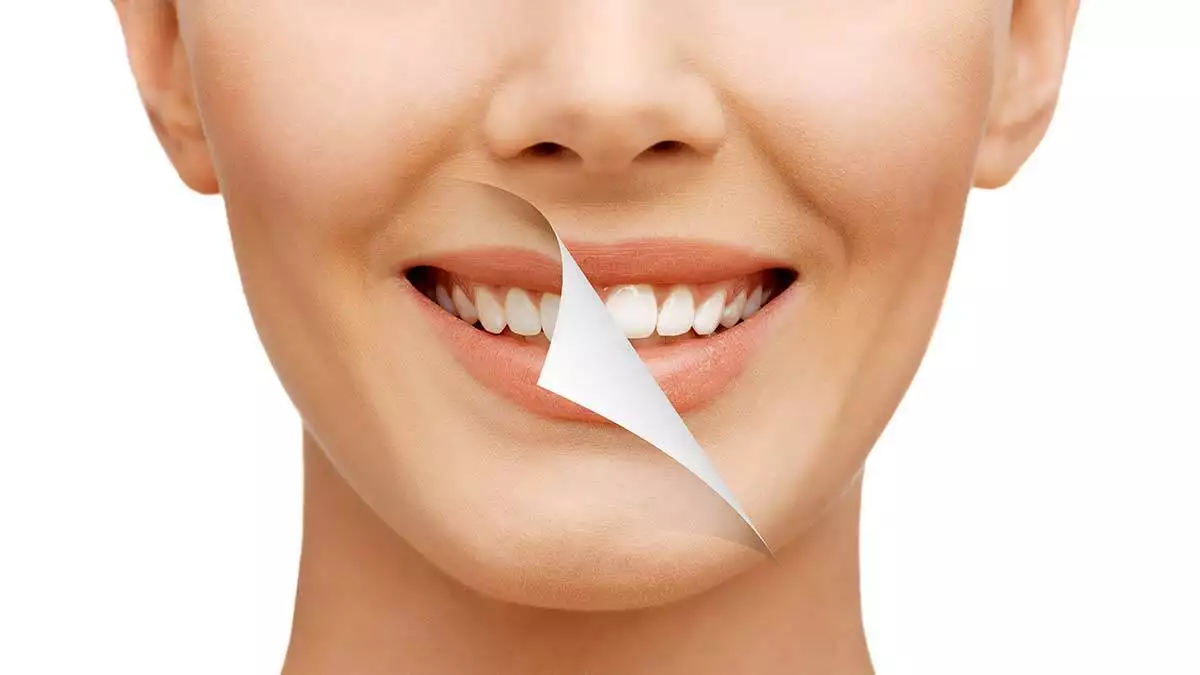 Sarı dişlerden beyaz dişlere geçmenin 4 yolu