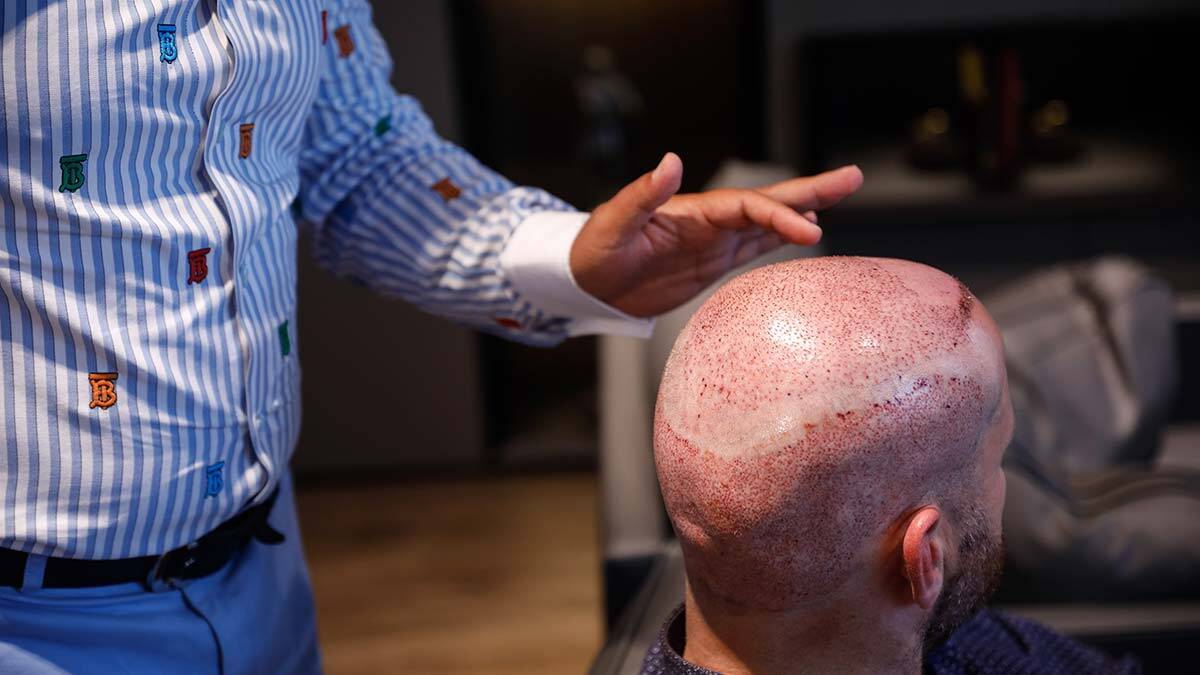 Saç ekiminde ilk tercih edilen ülke Türkiye