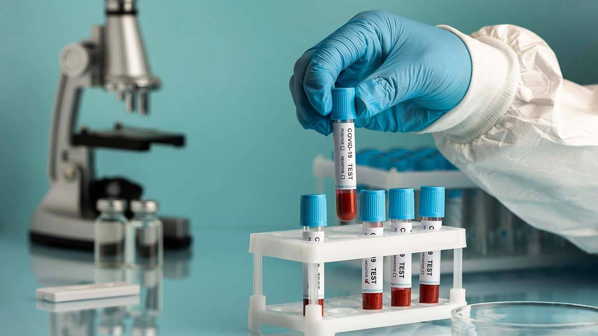 Sağlık Bakanı: Yeni vaka sayılarımız 30 bine yaklaştı