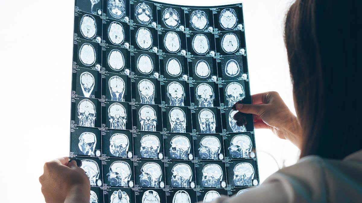 Tespitlerde geç kalınması tedavileri aksatıyor