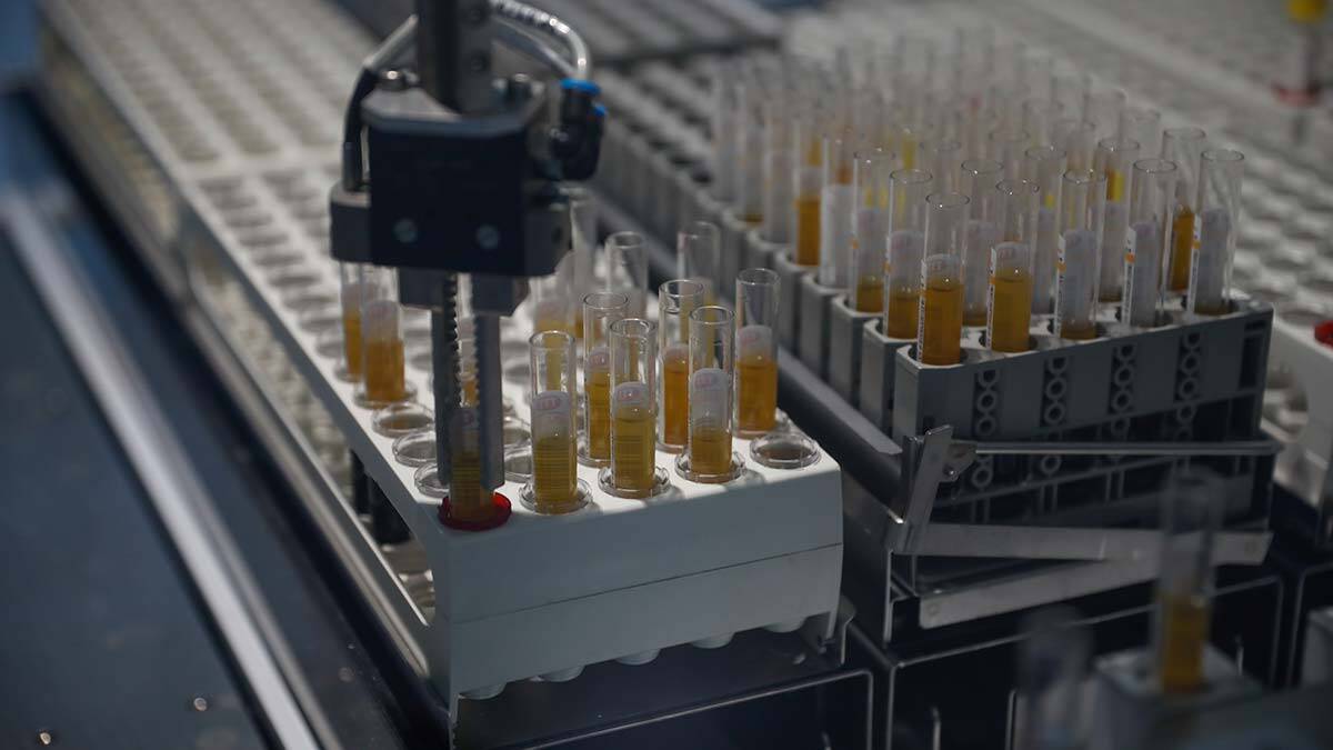 Türkiye'de ilk: Şehrin tüm testleri tek çatı altında