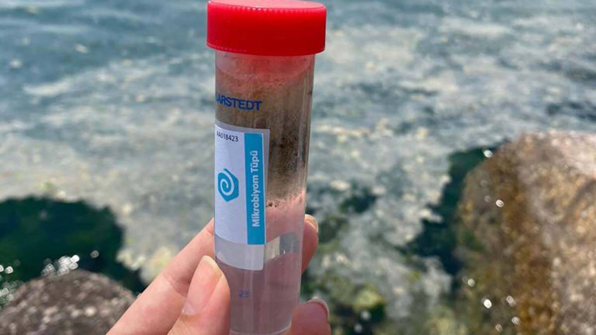 Yerli biyoteknoloji girişimine TÜBİTAK'tan destek