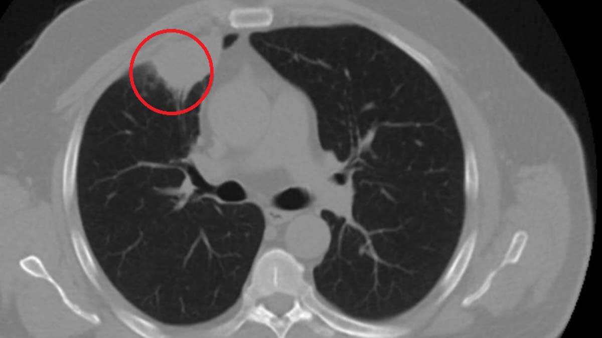 Dünya tıp literatüründe bir ilk