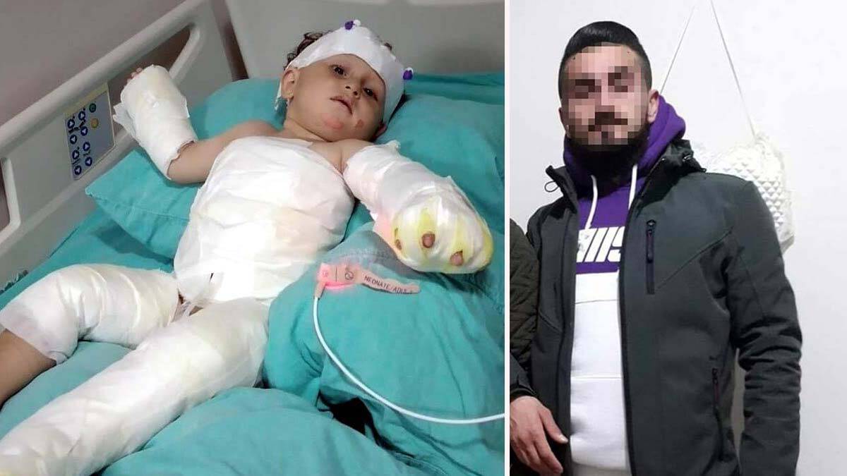 Eşi ve oğlunu üzerine kolonya dökerek yaktı