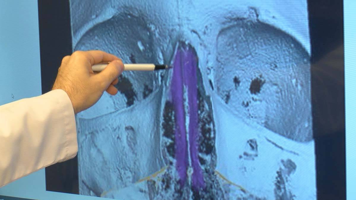 Covid-19 sonrası tat-koku kaybında önemli araştırma