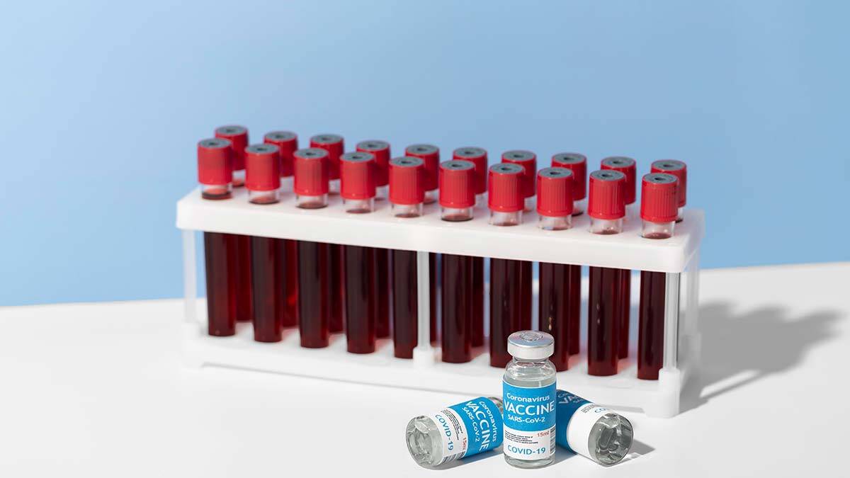 Covid-19 vaka sayısı 28 bin 192 oldu