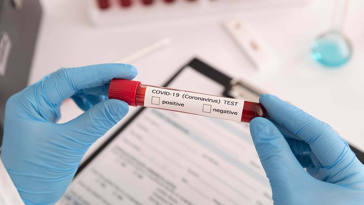 Günlük Covid-19 vaka sayısı 25 bin 528