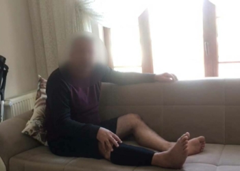 Pompalı ile yaralanan memurun bacağı parçalandı
