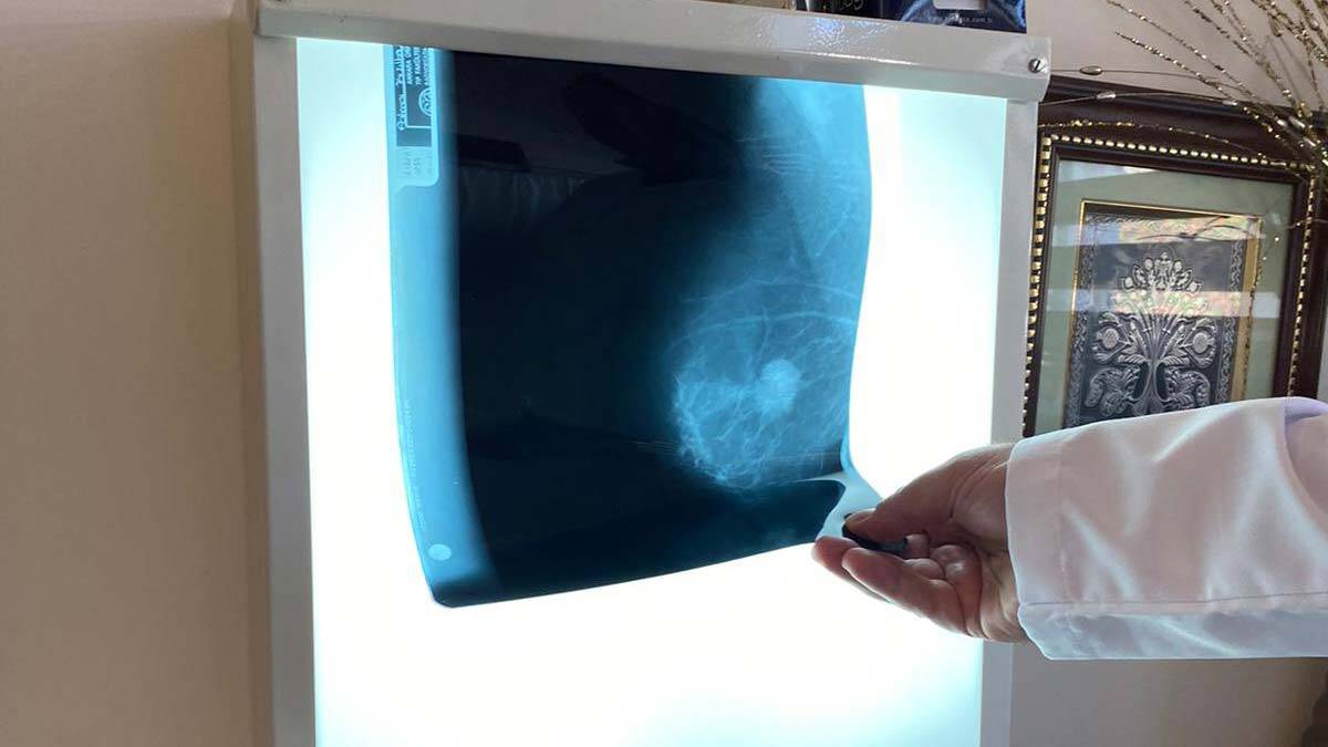 Prof. Dr. Bayar: Emzirme meme kanseri riskini azaltıyor