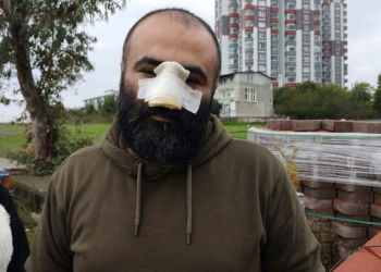 Tasmasız pitbull cinsi köpek iş insanına saldırdı