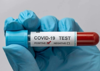 Covid-19 felaket senaryoları