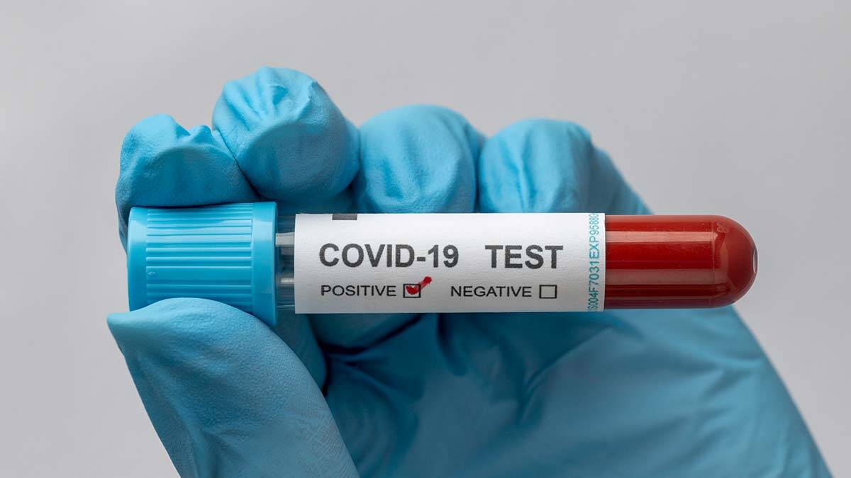 Covid-19 felaket senaryoları