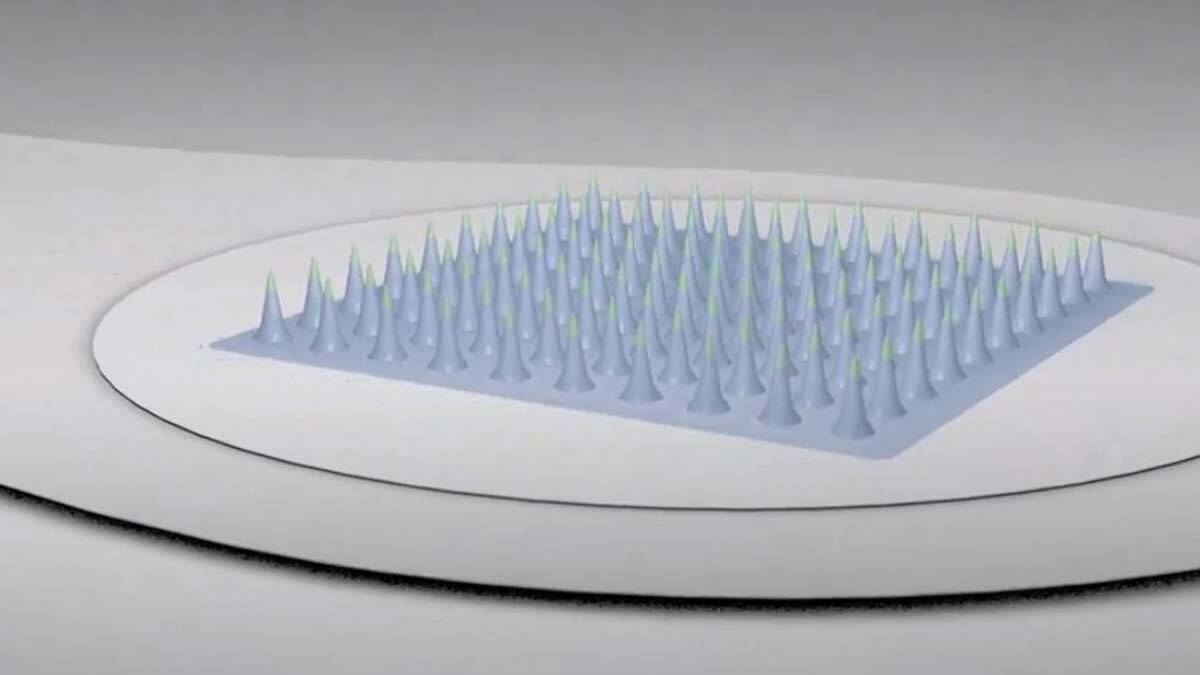 Cilt bantı tasarımlı Covid-19 aşısı deney aşamasında