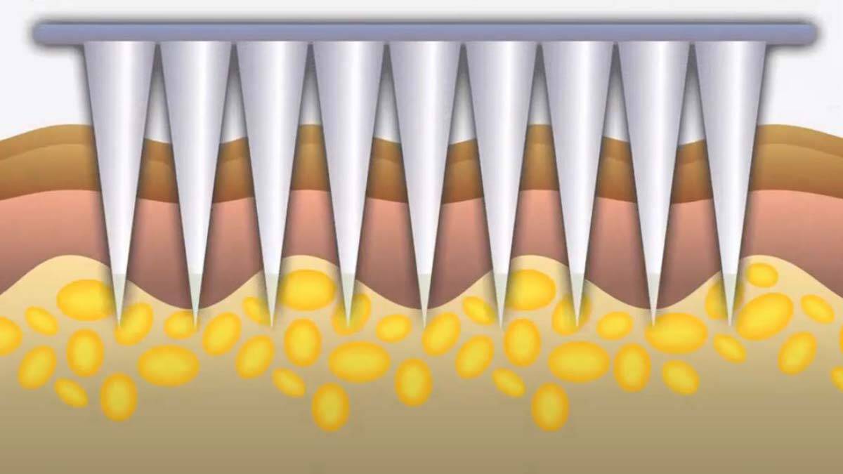 Aşının, Covid-19 varyantlarına karşı etkili olabileceği ve diğer mevcut aşılardan daha uzun süre koruma sağlayabileceği vurgulandı