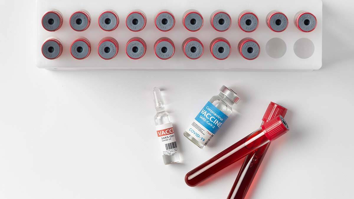 Covid-19 günlük vaka sayısı 28 bin 193 oldu