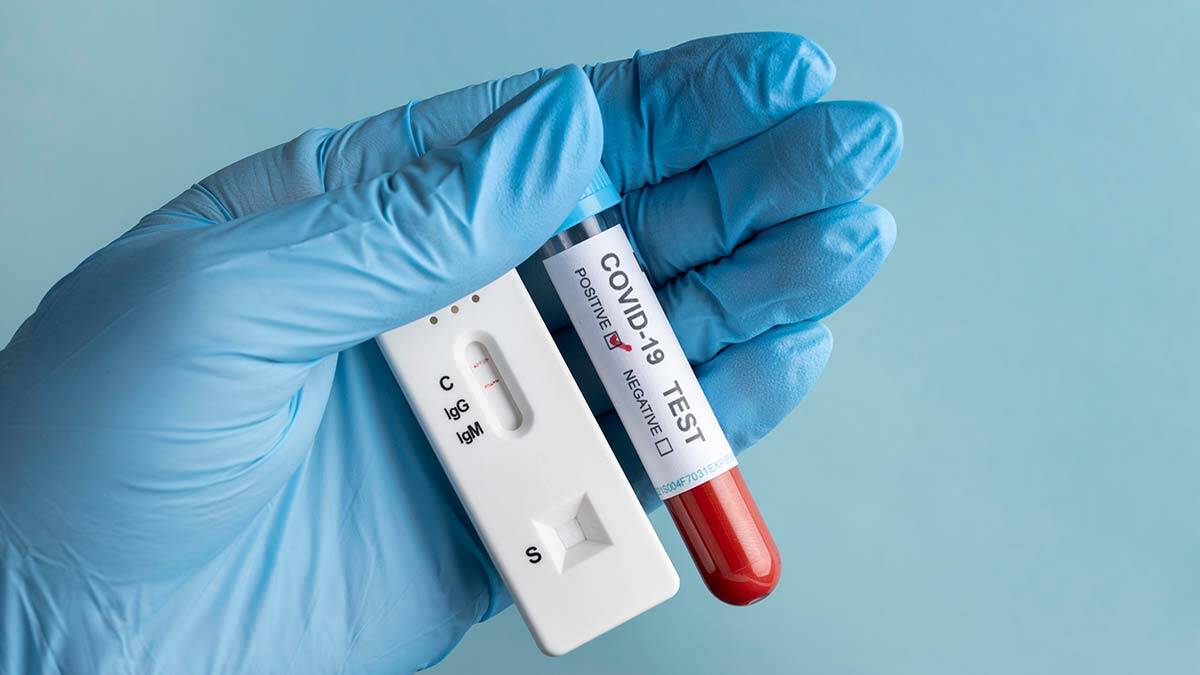 Günlük Covid-19 vaka sayısı 24 bin 2 oldu