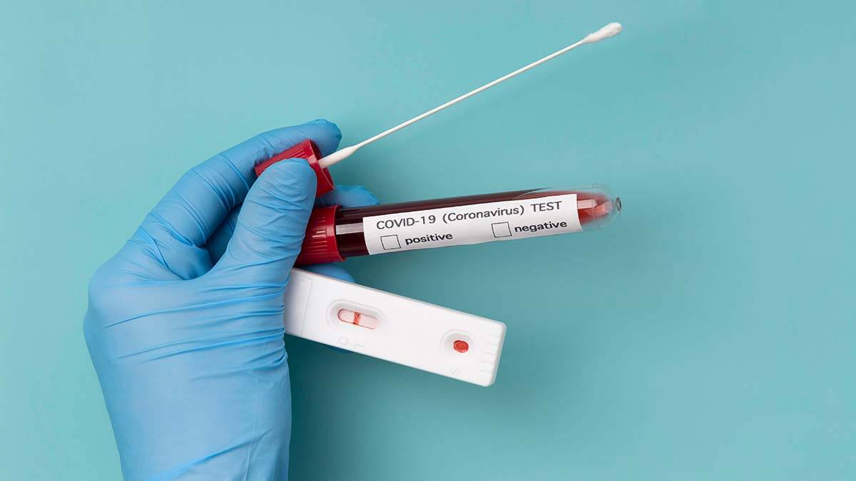 Günlük Covid-19 vakası 27 bin 259 oldu