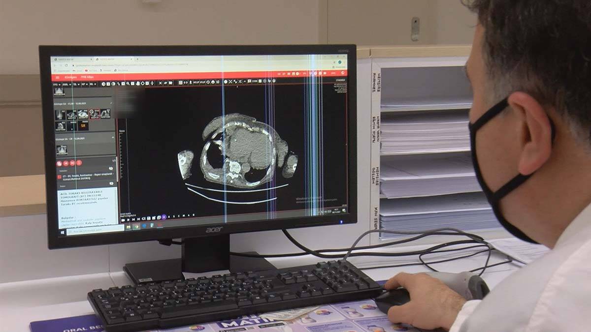 Koronavirüste kanser ve kalp hastalığı riski