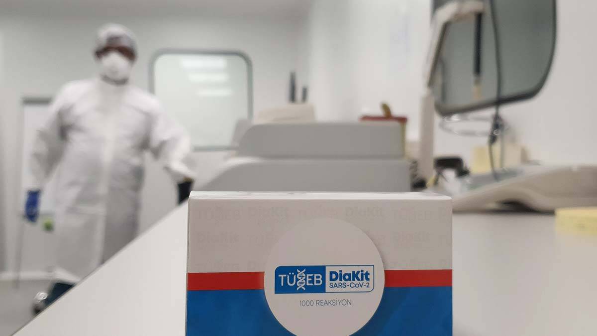 Yeni Covid PCR tanı kiti yolda