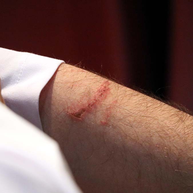 " Odaya girip bana yumruk attı. Ben de tabi kendimi savunmaya çalıştım"