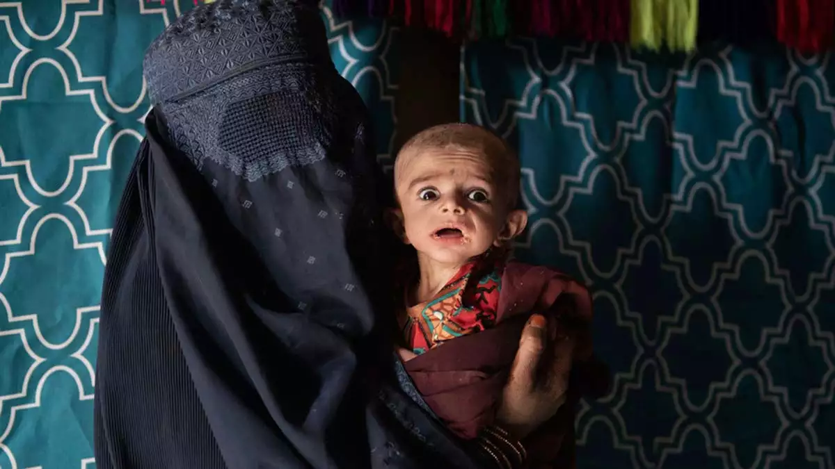 Afganistan'ı eşi görülmemiş açlık bekliyor