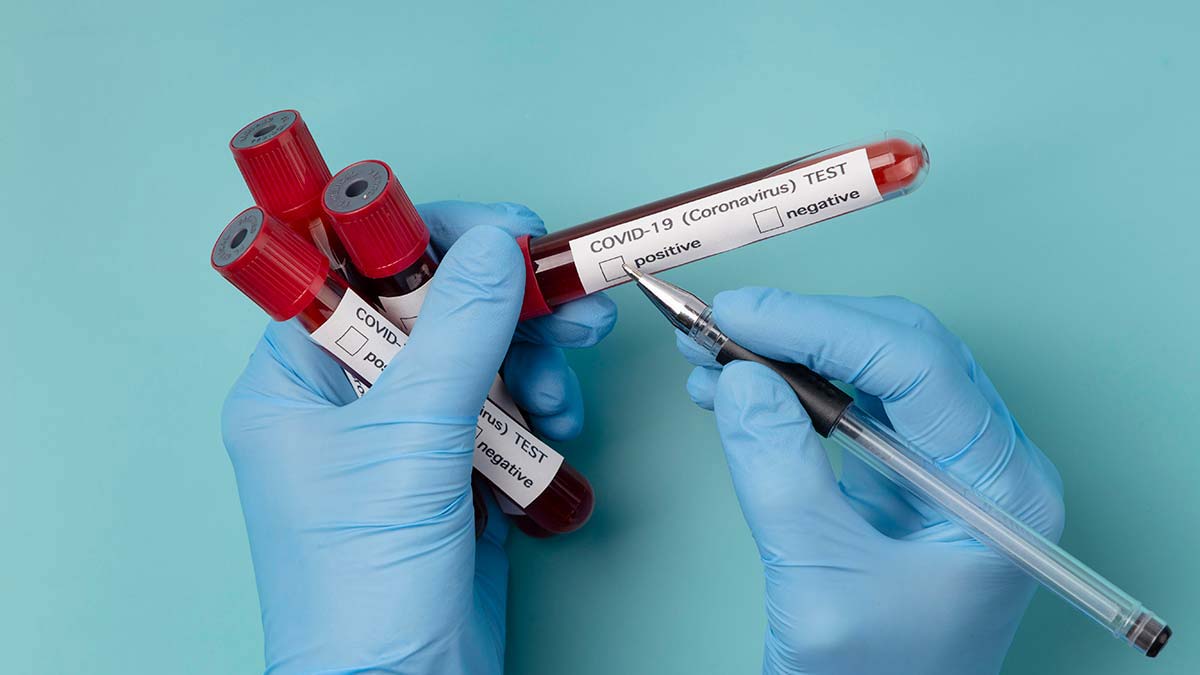 Koronavirüs tablosuna göre 19 bin 255 yeni vaka