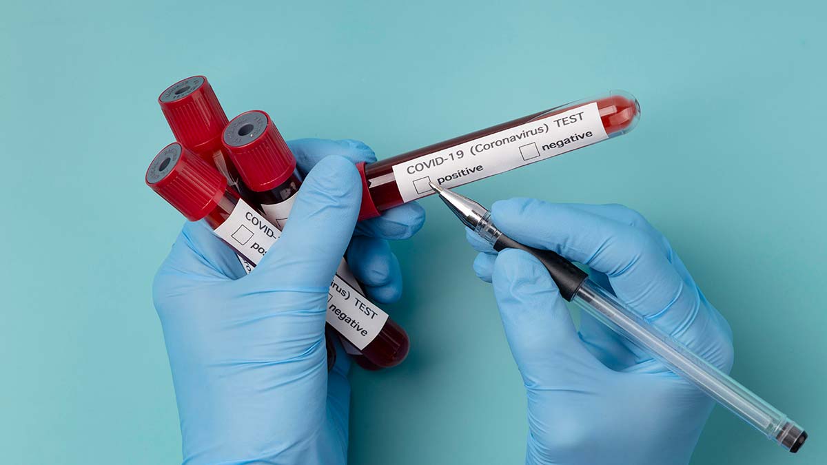 Günlük Covid-19 vaka sayısı 20 bin 374 oldu