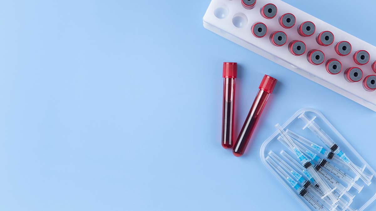 Günlük covid-19 vakası 20 bin 33 oldu