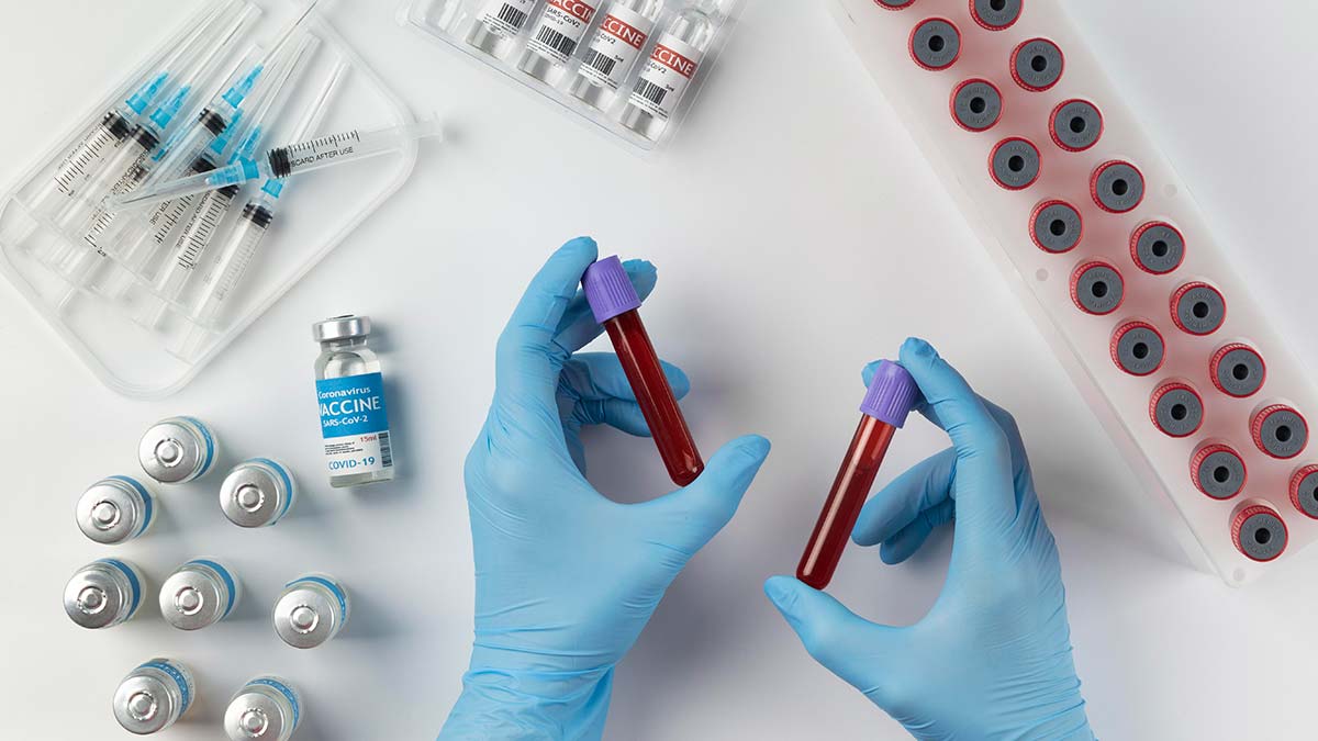 Günlük vaka sayısı 20 bin 470 oldu