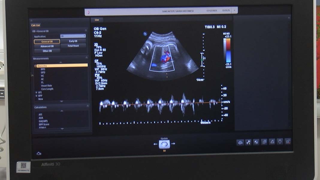 "Artık ikisi de sağlıkla taburcu olacak. Ebru'nun gebeliği sağlıkla devam ediyor"