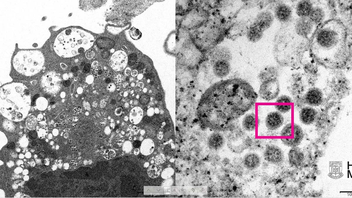 Omicron'un elektron mikroskobu görüntüsü çıkarıldı