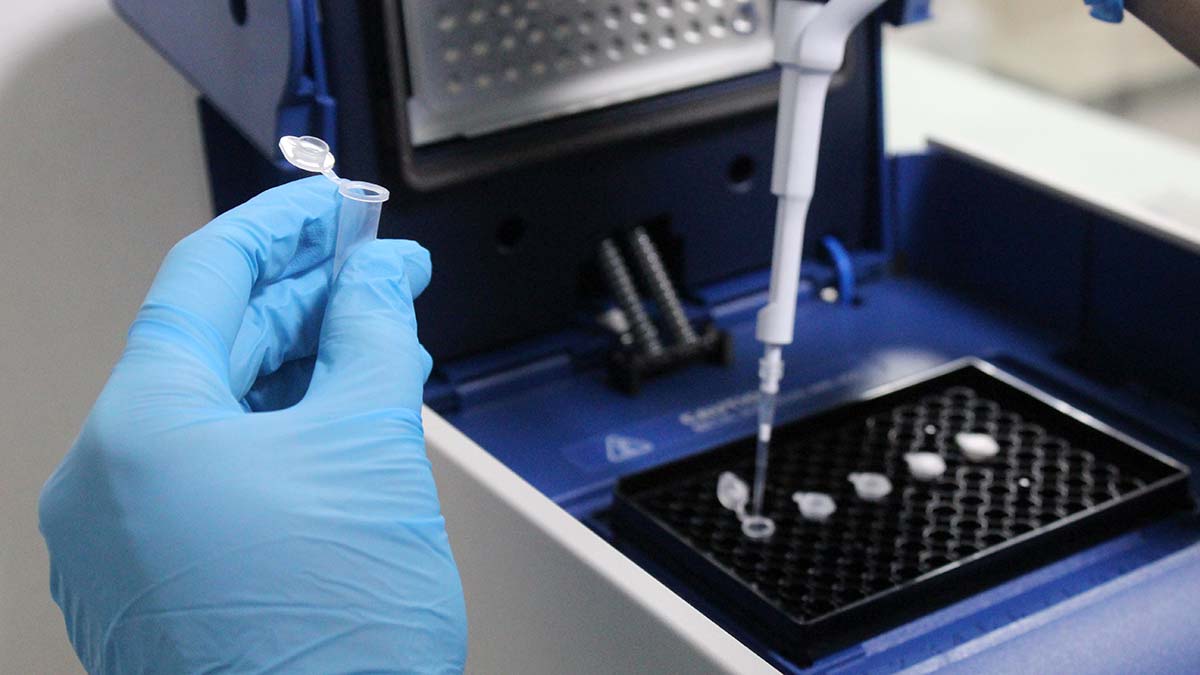 " Bu test genetik merkezlerde kamu veya özellerde yapabilecek düzeyde altyapıları hazır"