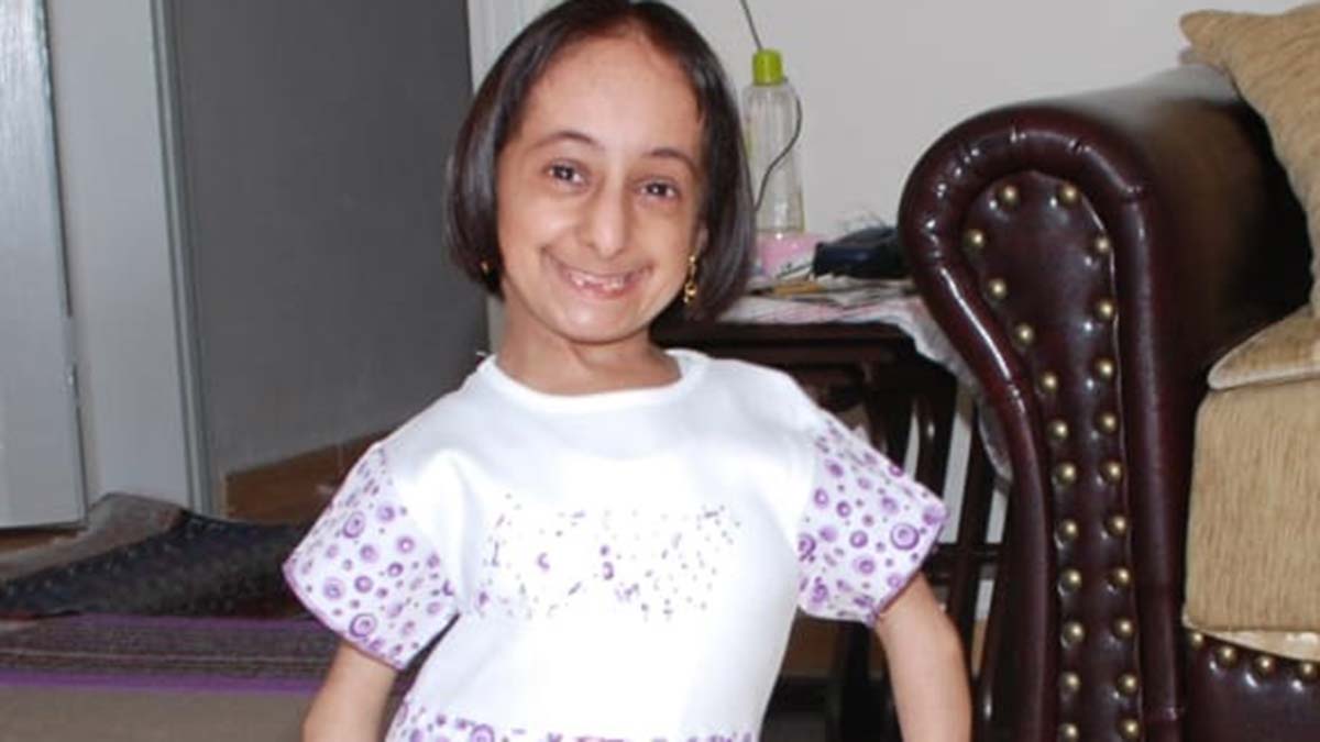 Türkiye'nin en kısa boylu kadını hayatını kaybetti