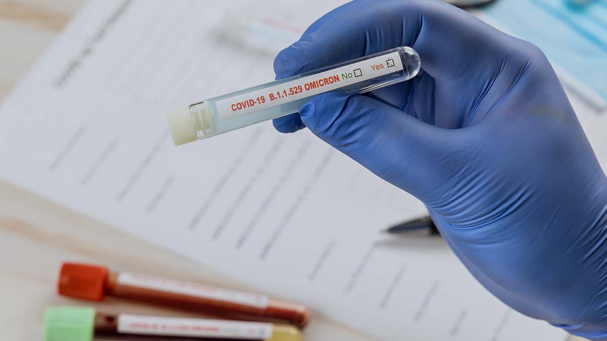 Vaka sayısı Eskişehir'de arttı