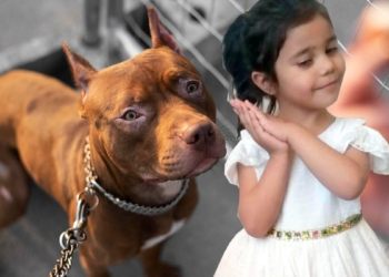 Pitbull saldırısı sonrası doku nakli yapılan Asiye, servise alındı
