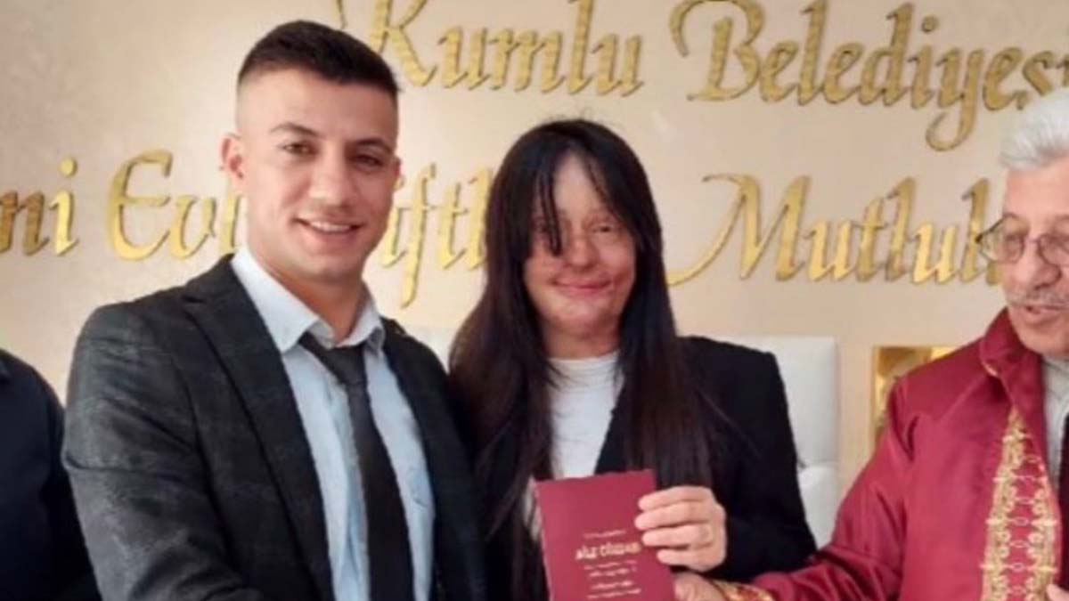 Ağaçlar ayakta ölür