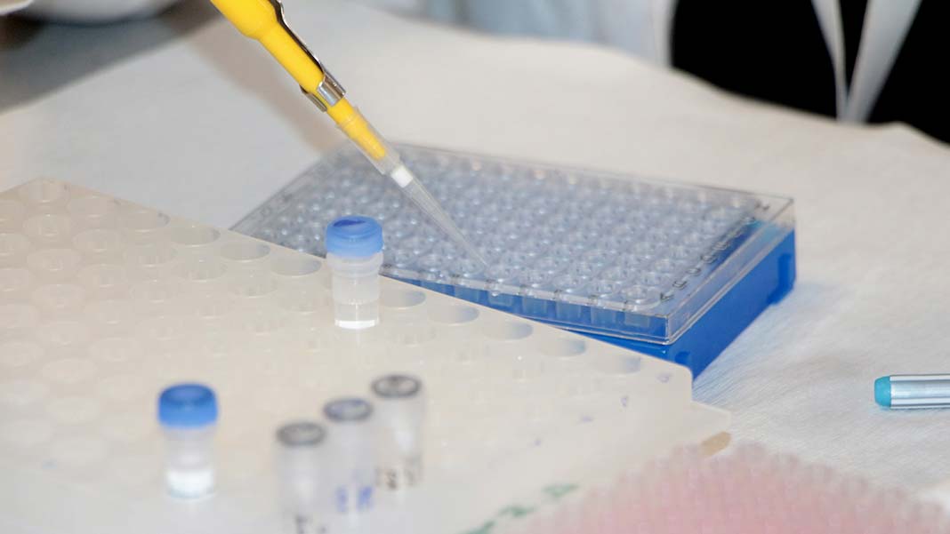 Gen mutasyonu kaynaklı obezite hastalarına umut ışığı