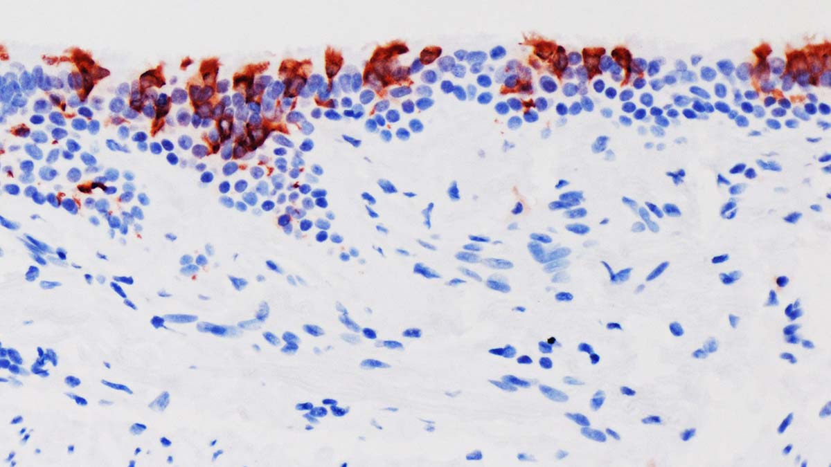 Omicron Delta'dan daha hızlı bulaşıyor