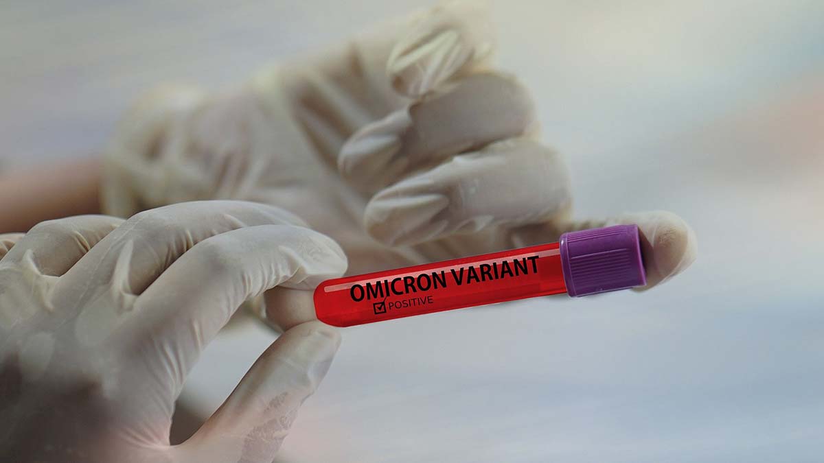 Covid-19'dan en fazla can kaybı Almanya'da