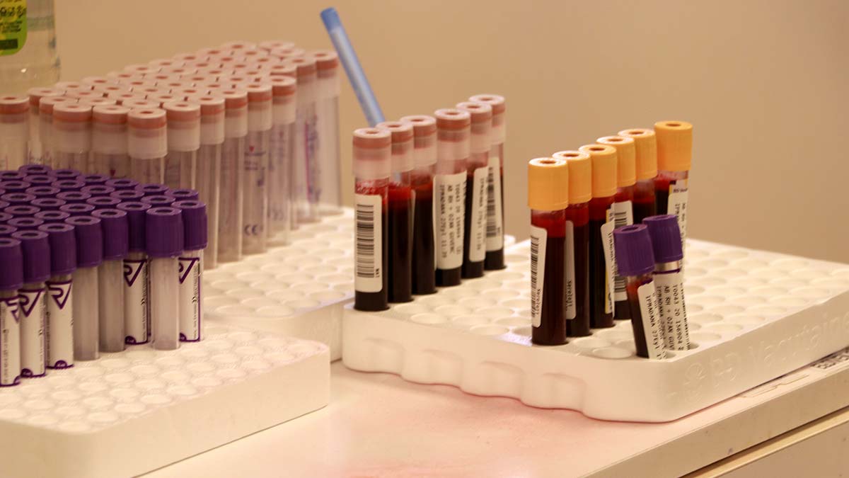 Bağışlanan 660 bin ünite kan hastalara umut oldu