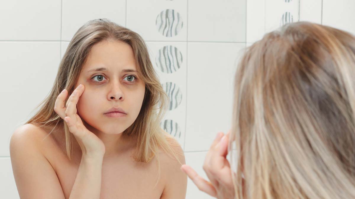 Gözaltı morlukları karbondioksitle tedavi edilebilir