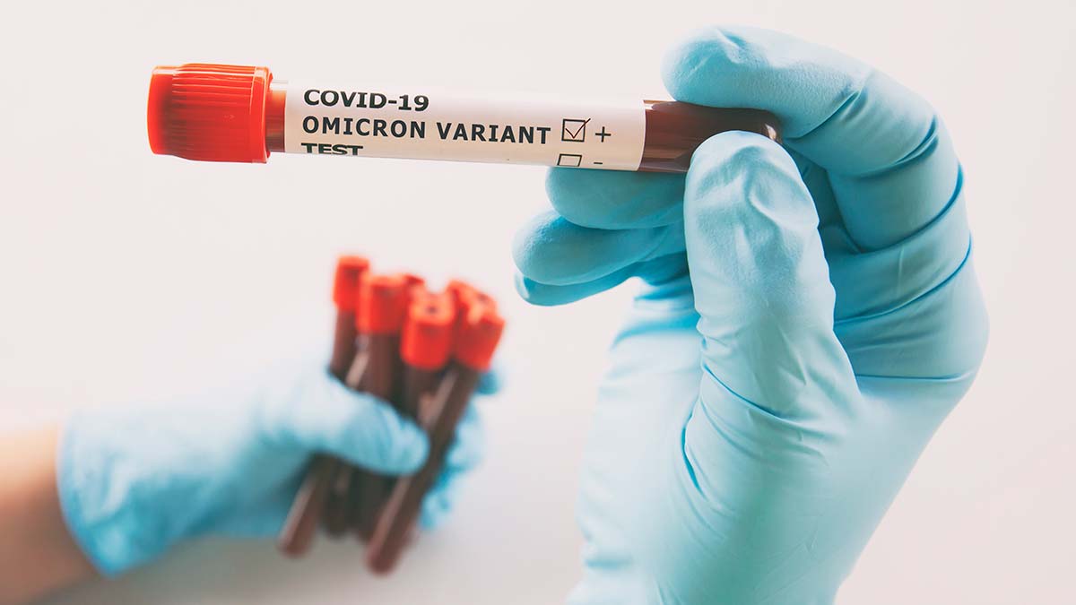 Koronavirüs günlüğüm