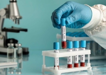 Omicron PCR test yükünü artırdı