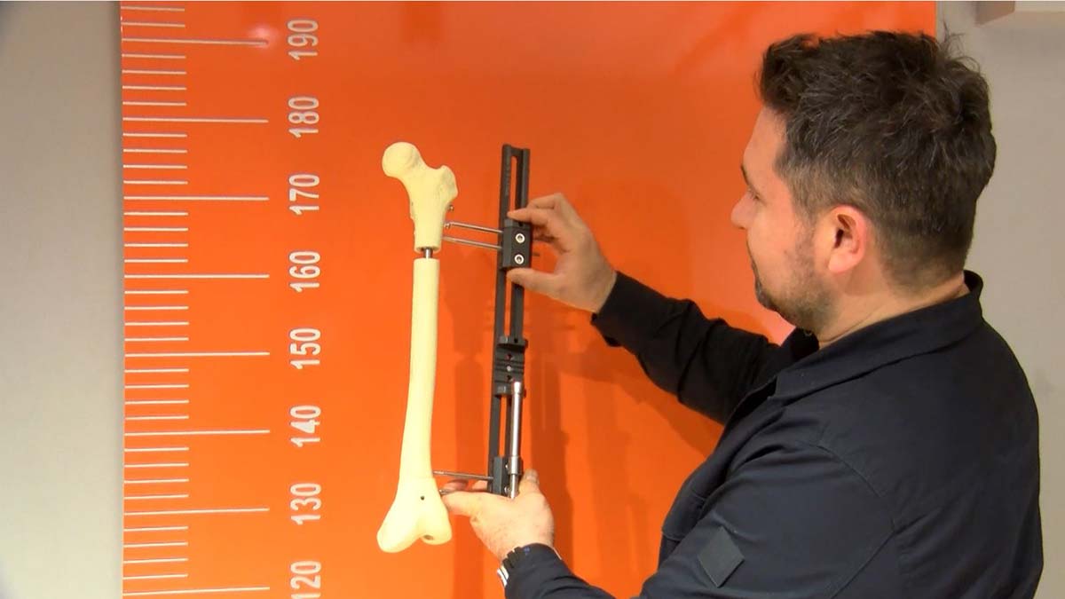 Boyu kısa olanlar ameliyatla 13 santim uzayabiliyor